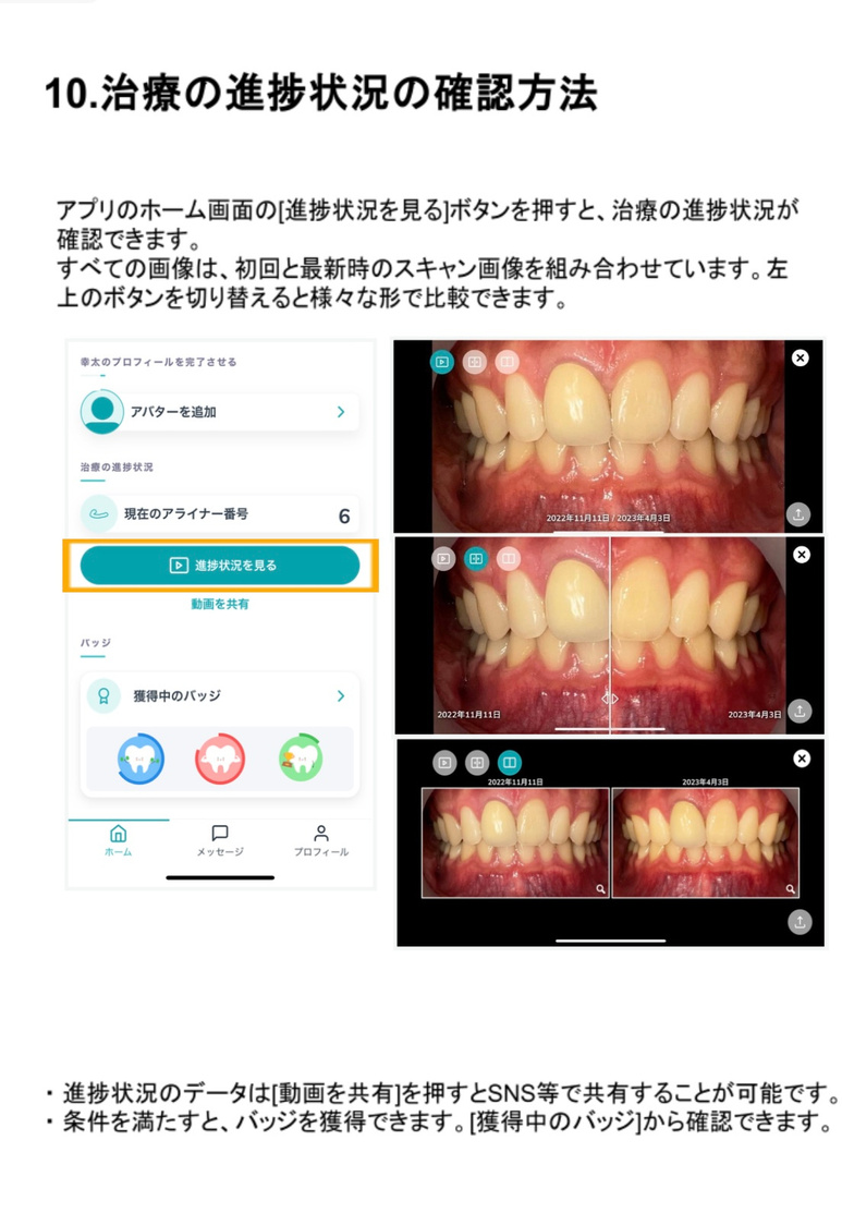 進捗状況を見るボタンと歯の比較画面
